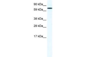 Western Blotting (WB) image for anti-Forkhead Box O6 (Foxo6) antibody (ABIN2461559) (Foxo6 Antikörper)