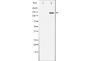 Western blot analysis of Bcr expression in HepG2 whole cell lysates,The lane on the left is treated with the antigen-specific peptide. (BCR Antikörper  (Internal Region))