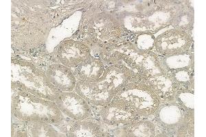 ABIN6256074 and ABIN6267116 at 1/100 staining human normal kidney tissue by IHC-P. (FLT3 Antikörper  (pTyr969))