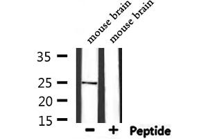 Western Blotting (WB) image for anti-CD9 (CD9) (Internal Region) antibody (ABIN6260660)