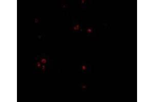 Immunofluorescence of MDA5 in Human Lymph Node cells with MDA5 Antibody  at 20 mg/ml (IFIH1 Antikörper  (Center))