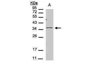 WB Image Sample(30 μg of whole cell lysate) A:293T 12% SDS PAGE antibody diluted at 1:1000 (CXCR6 Antikörper)