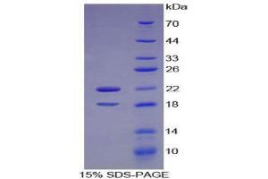 SDS-PAGE (SDS) image for Colony Stimulating Factor 2 Receptor, Alpha, Low-Affinity (Granulocyte-Macrophage) (CSF2RA) (AA 103-264) protein (His tag) (ABIN1170144) (CSF2RA Protein (AA 103-264) (His tag))