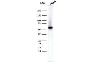 Western Blot of HeLa cell lysate Using Fascin-1 Mouse Monoclonal Antibody (FSCN1/417) (Fascin Antikörper)