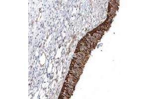 Immunohistochemical staining of human nasopharynx with DNAH1 polyclonal antibody  shows strong cytoplasmic and membranous positivity in respiratory epithelial cells at 1:200-1:500 dilution. (DNAH1 Antikörper)