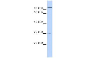 Sarcospan antibody used at 1 ug/ml to detect target protein. (SSPN Antikörper)