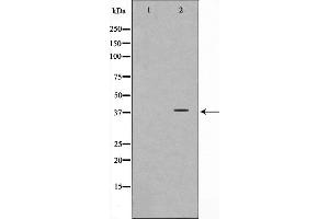 Western blot analysis on LOVO cell lysate using Synaptophysin Antibody,The lane on the left is treated with the antigen-specific peptide. (Synaptophysin Antikörper  (Internal Region))