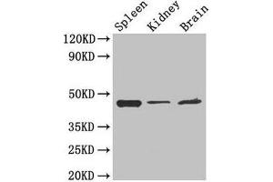 Western Blot Positive WB detected in: Mouse spleen tissue, Mouse kidney tissue, Mouse brain tissue All lanes: LAMP2 antibody at 4 μg/mL Secondary Goat polyclonal to rabbit IgG at 1/50000 dilution Predicted band size: 45, 46 kDa Observed band size: 45 kDa