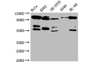 Western Blot Positive WB detected in: Hela whole cell lysate, SH-SY5Y whole cell lysate, K562 whole cell lysate All lanes: OFD1 antibody at 1:2000 Secondary Goat polyclonal to rabbit IgG at 1/50000 dilution Predicted band size: 117, 43, 112 kDa Observed band size: 117 kDa (OFD1 Antikörper  (AA 598-771))