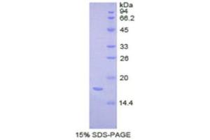 SDS-PAGE (SDS) image for Complexin 2 (CPLX2) (AA 2-134) protein (His tag) (ABIN1877474)