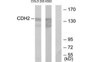 Western blot analysis of extracts from COLO205/K562 cells, using CDH2 Antibody. (N-Cadherin Antikörper  (AA 721-770))