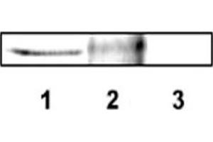 Western blot analysis of DLX4 using DLX4 polyclonal antibody . (DLX4 Antikörper  (AA 1-60))