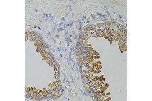 Immunohistochemistry of paraffin-embedded human prostate using TRPA1 antibody. (TRPA1 Antikörper)