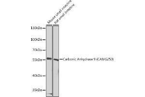 Western blot analysis of extracts of various cell lines, using Carbonic Anhydrase 9 (C/G250) Antibody (ABIN6131266, ABIN6137798, ABIN6137800 and ABIN6217767) at 1:1000 dilution. (CA9 Antikörper  (AA 52-151))