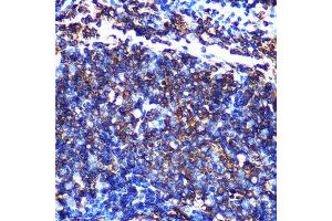 Immunohistochemistry of paraffin-embedded mouse spleen using HLA-DQ Rabbit mAb (1252) at dilution of 1:100 (40x lens). (HLA-DQA1 Antikörper)