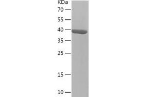 L2HGDH Protein (AA 80-249) (His-IF2DI Tag)