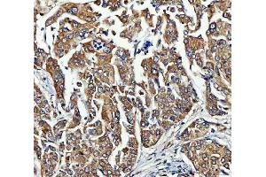 IHC analysis of FRY using anti-FRY antibody (ABIN7599716). (FRY Antikörper  (AA 11-3013))