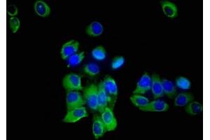 Immunofluorescent analysis of A549 cells using ABIN7170231 at dilution of 1:100 and Alexa Fluor 488-congugated AffiniPure Goat Anti-Rabbit IgG(H+L) (SLC35F2 Antikörper  (AA 335-374))