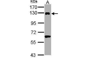 DDB1 Antikörper  (C-Term)