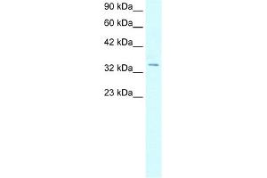 WB Suggested Anti-HOXD12 Antibody Titration:  5. (HOXD12 Antikörper  (N-Term))