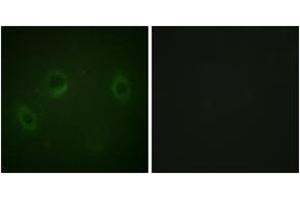 Immunofluorescence analysis of HeLa cells, using MARK1/2/3/4 (Ab-215) Antibody. (MARK1/2/3/4 Antikörper  (AA 181-230))
