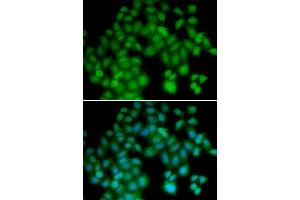 Immunofluorescence analysis of HeLa cells using TMSB4X antibody (ABIN3213357). (TMSB4X Antikörper)