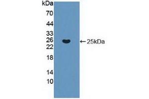 Detection of Recombinant KRAS, Human using Polyclonal Antibody to V-Ki-Ras2 Kirsten Rat Sarcoma Viral Oncogene Homolog (KRAS) (K-RAS Antikörper  (AA 1-189))