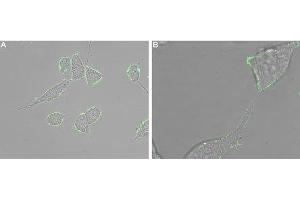 Expression of CXCR5 in human LNCaP cells - Cell surface detection of CXCR5 in intact living human prostate carcinoma (LNCaP) cells. (CXCR5 Antikörper  (Extracellular))