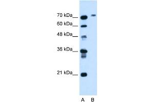 WB Suggested Anti-BCHE Antibody Titration:  1. (Butyrylcholinesterase Antikörper  (N-Term))
