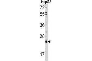 Western blot analysis of TIMP3 Antibody (Center) in HepG2 cell line lysates (35 µg/lane). (TIMP3 Antikörper  (Middle Region))