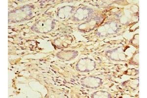 Immunohistochemistry of paraffin-embedded human small intestine tissue using ABIN7150796 at dilution of 1:100 (DYRK4 Antikörper  (AA 201-520))