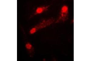 Immunofluorescent analysis of LIMK2 staining in COLO205 cells.