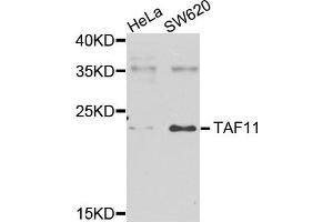 Western blot analysis of extracts of various cells, using TAF11 antibody. (TAF11 Antikörper)