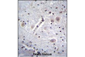 RK Antibody (C-term) (ABIN652301 and ABIN2841363) immunohistochemistry analysis in forlin fixed and paraffin embedded hun brain tissue followed by peroxidase conjugation of the secondary antibody and DAB staining.