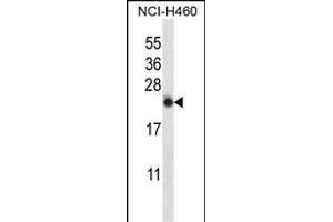 IL13 Antibody (C-term) (ABIN657659 and ABIN2846653) western blot analysis in NCI- cell line lysates (35 μg/lane). (IL-13 Antikörper  (C-Term))