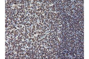 Image no. 13 for anti-F-Box Protein 21 (FBXO21) antibody (ABIN1498233) (FBXO21 Antikörper)