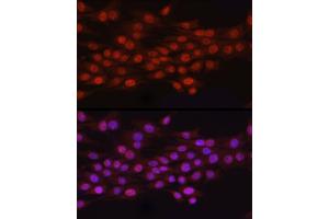 Immunofluorescence analysis of PC-12 cells using N6 Rabbit pAb (ABIN6131779, ABIN6144314, ABIN6144315 and ABIN6223027) at dilution of 1:100 (40x lens). (N6AMT1 Antikörper  (AA 1-186))