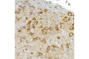 Immunohistochemistry of paraffin-embedded mouse brain using RPL13 Rabbit mAb (ABIN7269993) at dilution of 1:50 (40x lens). (RPL13 Antikörper)