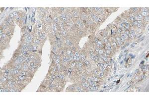 ABIN6272945 at 1/100 staining Human prostate tissue by IHC-P. (LDHB Antikörper  (N-Term))