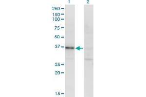 Western Blot analysis of RBKS expression in transfected 293T cell line by RBKS monoclonal antibody (M01), clone 3B4. (Ribokinase Antikörper  (AA 1-322))