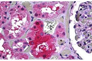 Human Kidney, Tubules: Formalin-Fixed, Paraffin-Embedded (FFPE)