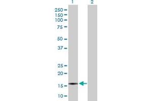 Western Blot analysis of CXCL5 expression in transfected 293T cell line by CXCL5 MaxPab polyclonal antibody. (CXCL5 Antikörper  (AA 1-114))