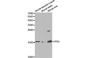 Western blot analysis of extracts of various cell lines, using UTS2 antibody. (Urotensin 2 Antikörper)