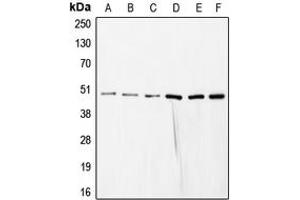 Western blot analysis of COPS3 expression in HeLa (A), SP2/0 (B), mouse liver (C), rat liver (D), NIH3T3 (E), HEK293T (F) whole cell lysates. (COPS3 Antikörper  (Center))