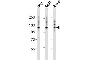 All lanes : Anti-ITGA7 Antibody (N-term) at 1:2000 dilution Lane 1: Hela whole cell lysates Lane 2: A431 whole cell lysates Lane 3: Jurkat whole cell lysates Lysates/proteins at 20 μg per lane. (ITGA7 Antikörper  (N-Term))