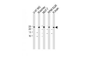 All lanes : Anti-C9orf95 Antibody (N-term) at 1:1000 dilution Lane 1: U-87 MG whole cell lysate Lane 2: M. (NMRK1 Antikörper  (N-Term))