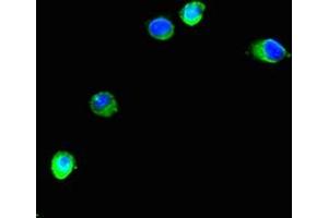 Immunofluorescent analysis of Hela cells using ABIN7151266 at dilution of 1:100 and Alexa Fluor 488-congugated AffiniPure Goat Anti-Rabbit IgG(H+L) (TRIM37 Antikörper  (AA 301-600))