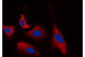Immunofluorescent analysis of CDK5 (pY15) staining in HEK293T cells. (CDK5 Antikörper  (N-Term, pTyr15))