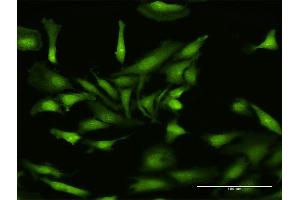 Immunofluorescence of purified MaxPab antibody to NLRP2 on HeLa cell. (NLRP2 Antikörper  (AA 1-1062))