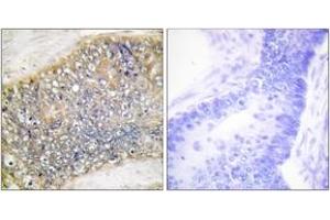 Immunohistochemistry (IHC) image for anti-Tumor Necrosis Factor (Ligand) Superfamily, Member 13 (TNFSF13) (AA 151-200) antibody (ABIN1533545)